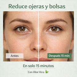 Chau ojeras! Parches de Aloe para ojeras y bolsas